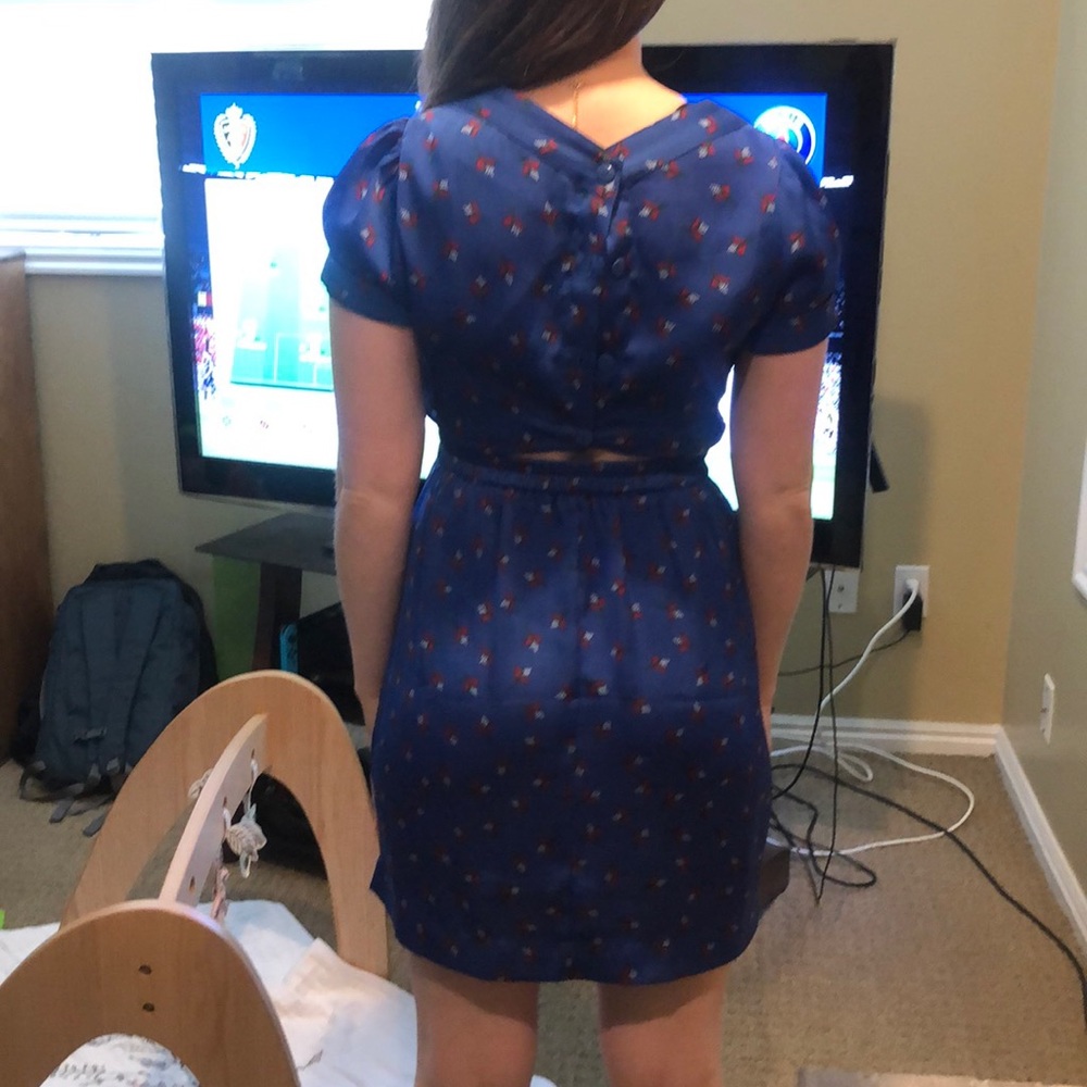 Blue patterned mini dress - Picture 4 of 6